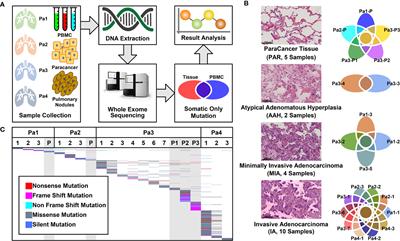 Mutational Pattern in Multiple Pulmonary Nodules Are Associated With Early Stage Lung Adenocarcinoma